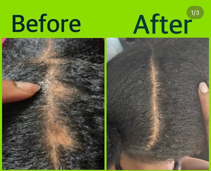 4 in1 Hair Growth Oil!